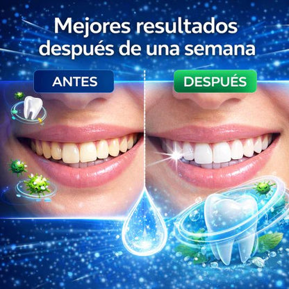 Blanqueador de dientes
